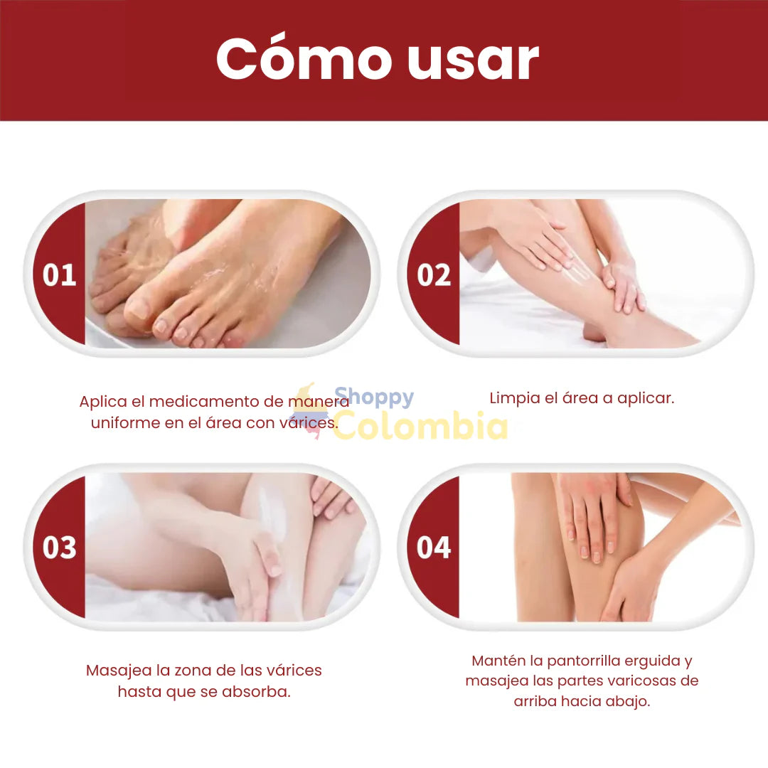 NEGUSY™ Crema Varicose Veins Para Varices y Pie Diabético